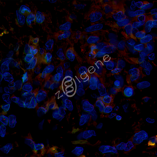 免疫荧光-双标（TSA）